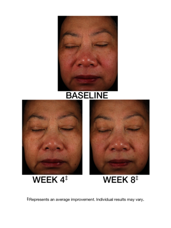 TimeWise Replenishing Serum C+E